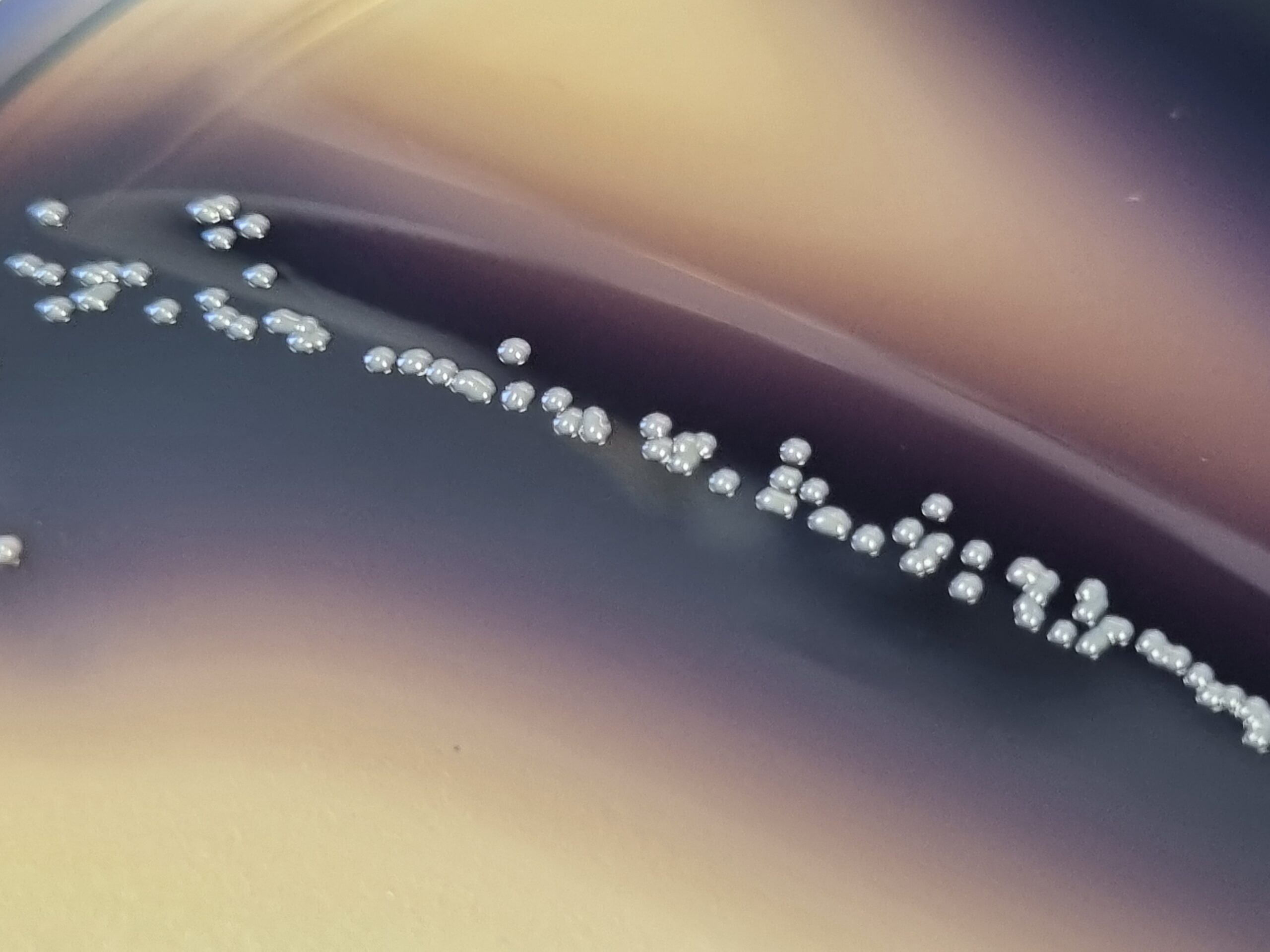 Enterococcosel Agar / Bile Esculin Azide Agar (Streptococ Grup D)