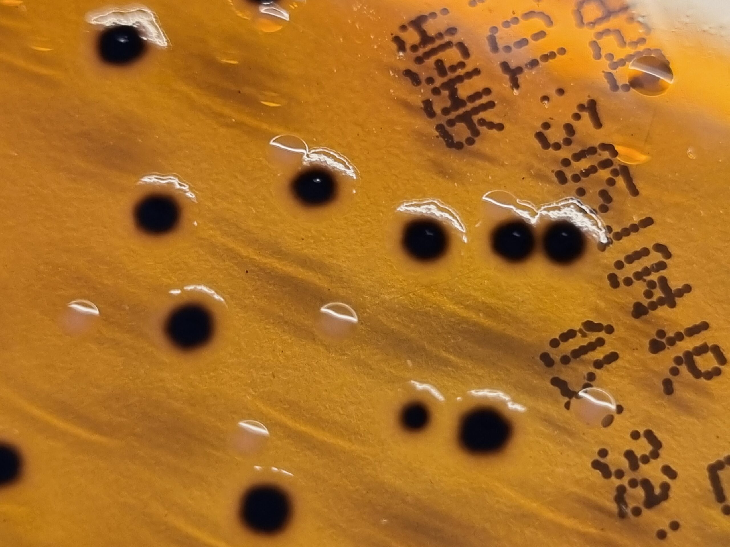 Salmonella Shigella Agar