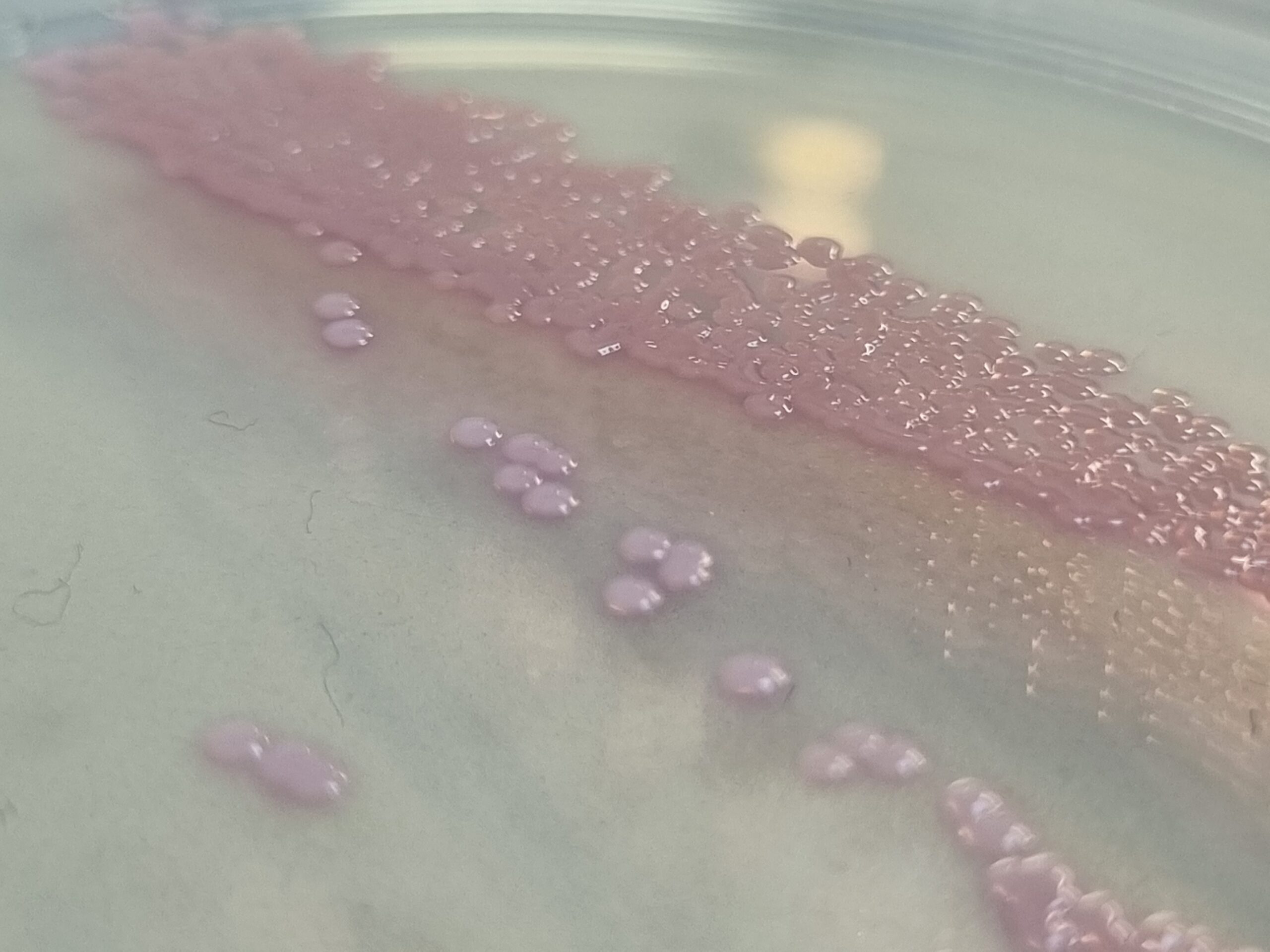 CHROMagar MRSA