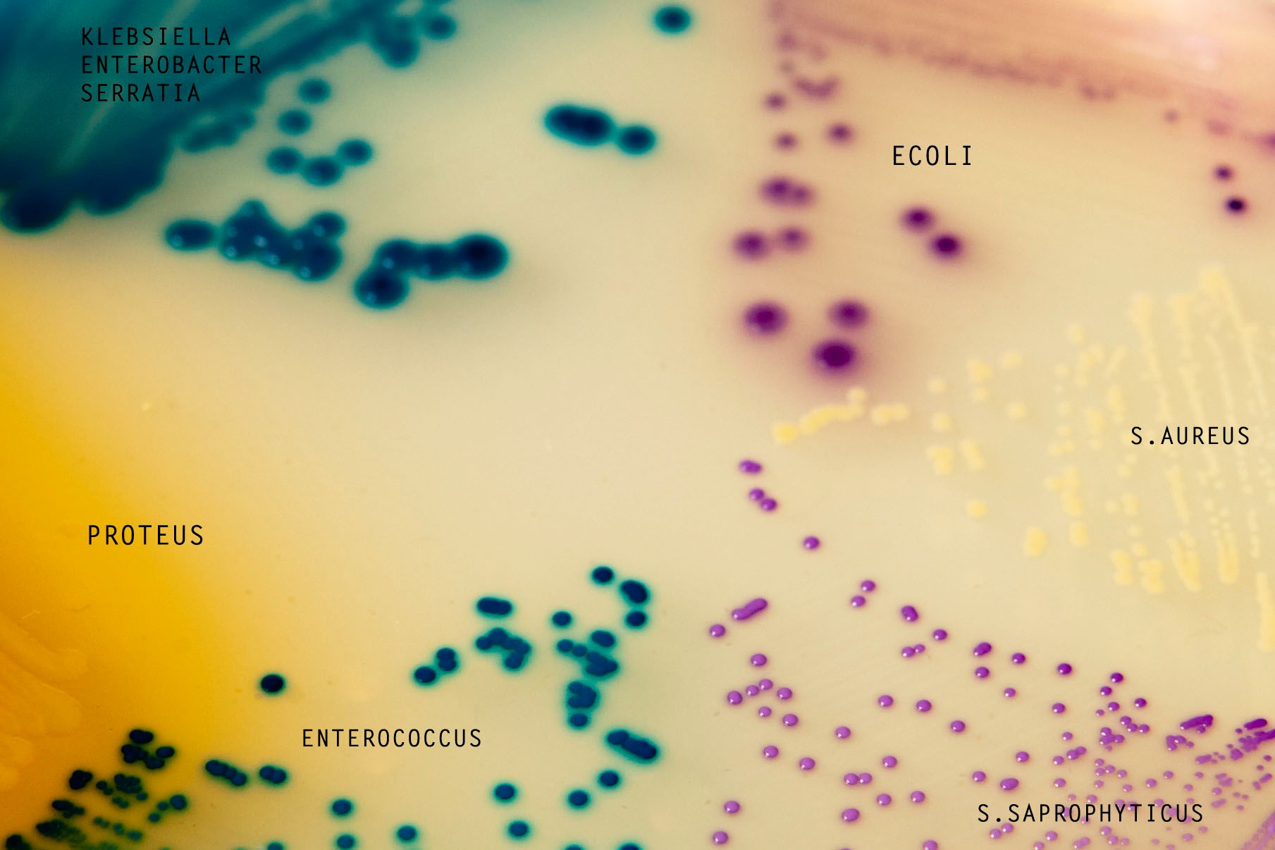 CHROMagar Orientation – Mediul cromogen UTI